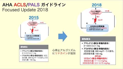 ACLS/PALSアルゴリズムにリドカインが追加2018アップデート
